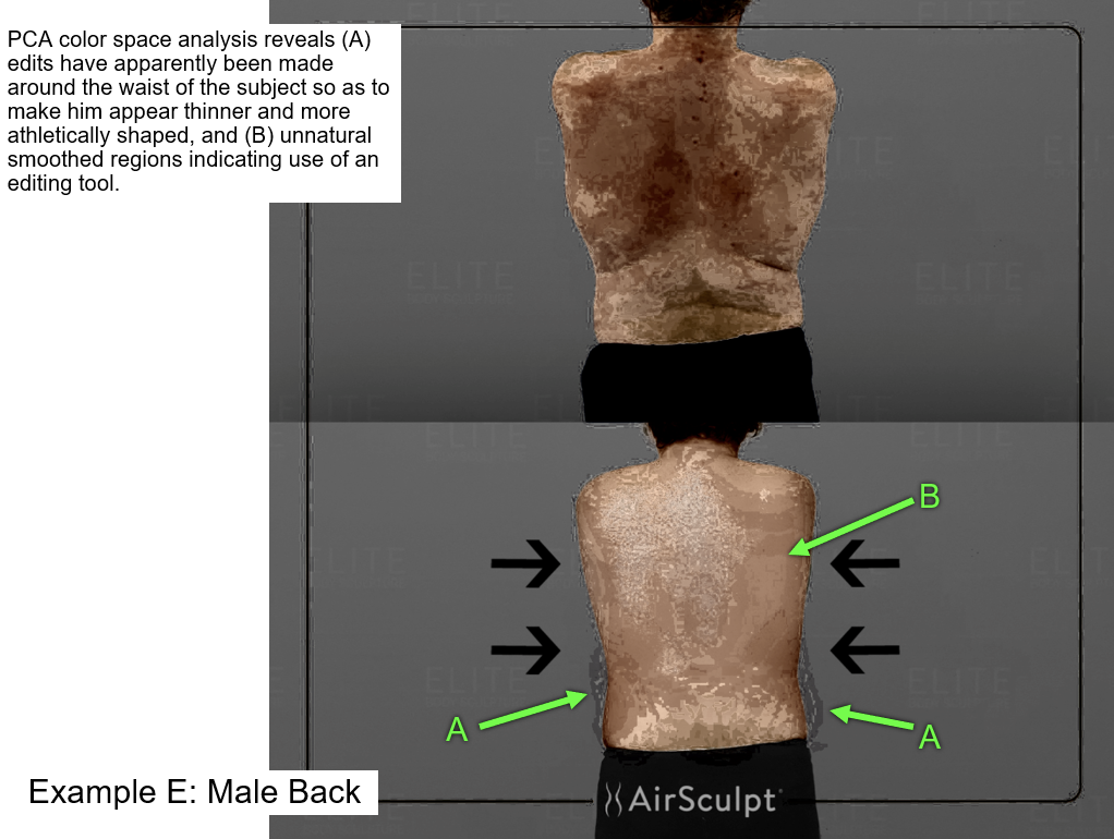 AirSculpt – A “Liposuction Chop-Shop's” Cover-up of Patient's Death,  Sanctioned/Under-Certified Doctors, Fabricated Reviews, and Photoshopped  Images Exposed - Fuzzy Panda Research